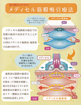 筋膜療法　筋膜リリース　癒着リリース　筋膜 あなたの筋膜リリースの理解間違ってるって知ってた？ | 美容室