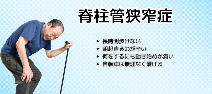 オファーバナー