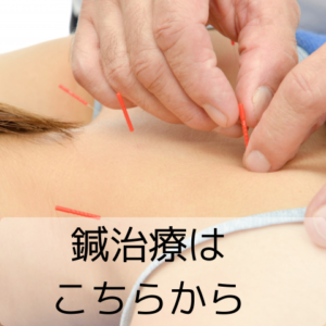 女性に鍼をしている